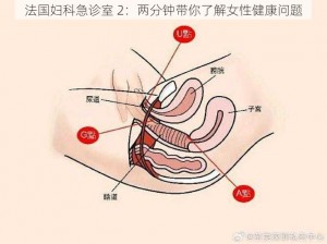 法国妇科急诊室 2：两分钟带你了解女性健康问题