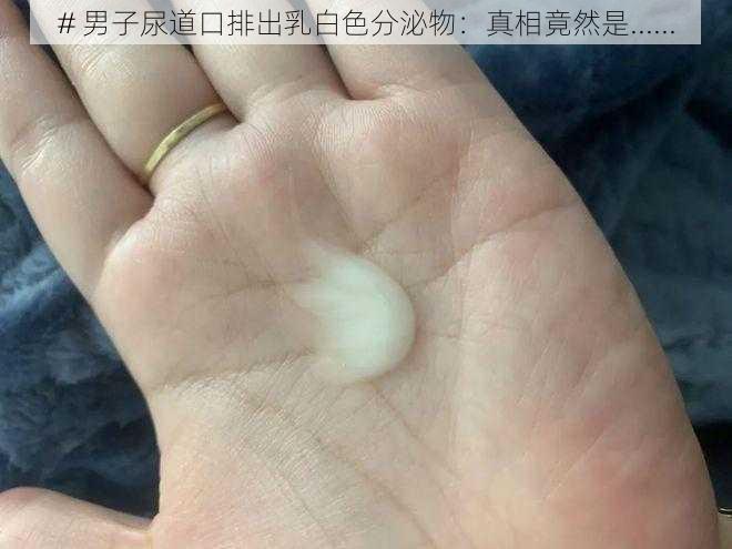 # 男子尿道口排出乳白色分泌物：真相竟然是......